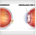 catarratta angelo minnella